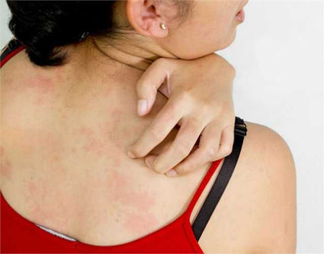 7. Loại cây đậu nành biến đổi gen: Gây ra các vấn đề sức khỏe. Hơn 90% cây trồng trên toàn thế giới đang biến đổi gen. Nước tương sản xuất từ đậu nành biến đổi gen chi phí ít hơn nhưng gây ra vấn đề sức khỏe như dị ứng.