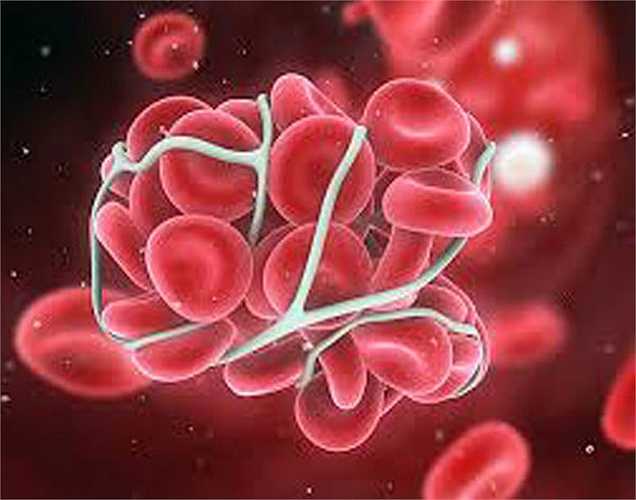 8. Đông máu: Các sản phẩm đậu nành có chứa hemagglutinin làm hồng cầu đông lại, gây thiếu oxy dẫn đến các cơn đau tim và các bệnh mãn tính khác. Đây là một thông tin rất quan trọng cho mọi người biết ảnh hưởng của nước tương với sức khỏe.