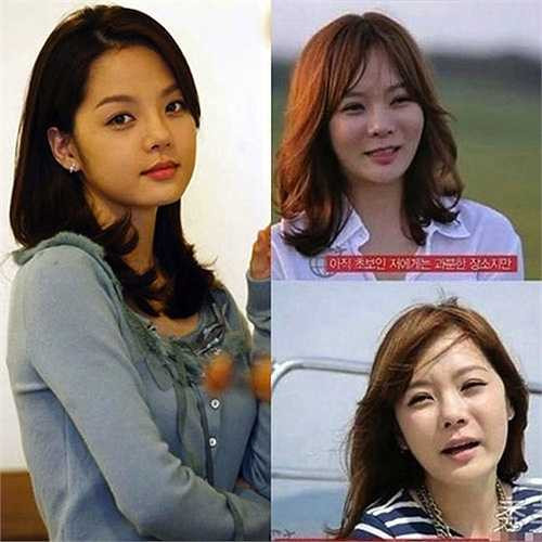 Tuy nhiên, sau thời gian im ắng với các hoạt động nghệ thuật, ngôi sao 39 tuổi xuất hiện với khuôn mặt khác lạ, đơ cứng 