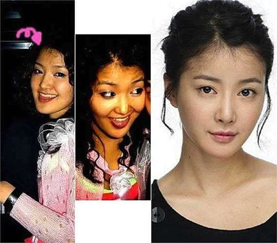 Ngôi sao quyền anh Lee Si Young vốn dĩ có khuôn mặt kém thanh mảnh, mũi tẹt 