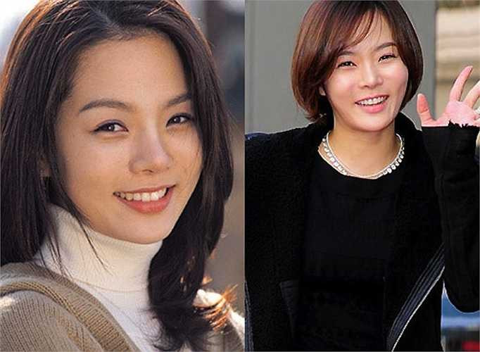 Cô từng thừa nhận sở mũi để khắc phục nhược điểm to và tẹt của bộ phận này, tuy nhiên nhìn vào khuôn mặt Chae Rim người hâm mộ chô rằng nữ diễn viên đã sửa nhiều hơn thế 