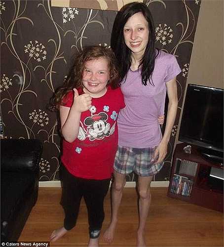 Dần dần, Jade bị mắc chứng biếng ăn vì nghiện giảm cân bằng việc đếm lượng calo trong thức ăn mà mình sẽ ăn mỗi ngày.