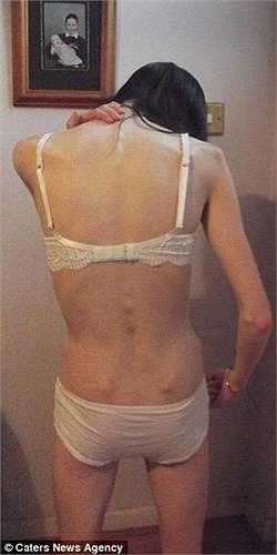 Mỗi ngày, Jade ăn một bát nhỏ ngũ cốc, một miếng hoa quả và một ít salad hay súp. ‘Tôi chỉ đang tồn tại chứ không phải đang sống, tôi thấy mình giống như zombie. Tôi không có năng lượng, động lực’, Jade chia sẻ.