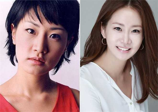 Shin Eun Kyung gọt cằm. Đây là phẫu thuật trình độ cao, có thể đe dọa tới mạng sống và chi phí không hề rẻ. Tuy nhiên, ngôi sao Vợ tôi là gangster vẫn quyết định thực hiện vì mọi người thường cho rằng gương mặt tự nhiên của cô trông như người đang tức giận. Nữ diễn viên 42 tuổi muốn thay đổi vẻ ngoài có phần nam tính để trở thành người phụ nữ mềm mại hơn. Shin Eun Kyung gọi đây là cuộc phiêu lưu nhưng cô không hối hận.