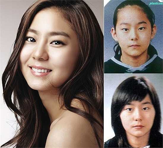 Tháng 1/2010, trong chương trình Sangsang Plus, UEE thú nhận: 'Tôi đã sửa mắt một chút'.