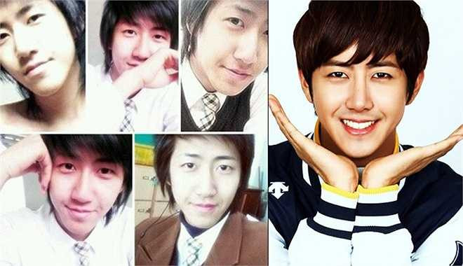 Trong một chương trình tạp kỹ, Kwang Hee cho biết, mẹ chính là người khuyến khích anh thay đổi. Bà nói 'Muốn làm người nổi tiếng, con phải đẹp'. Kwang Hee làm lại gần như toàn bộ gương mặt, từ mắt, mũi cho đến trán. Ngày tiến hành phẫu thuật, mẹ đưa Kwang Hee tới bệnh viện, còn anh mang theo một cuốn truyện tranh để đọc cho bớt buồn chán. Kwang Hee bộc bạch, nếu không làm ca sĩ, rất có thể anh sẽ trở thành tư vấn viên phẫu thuật thẩm mỹ.