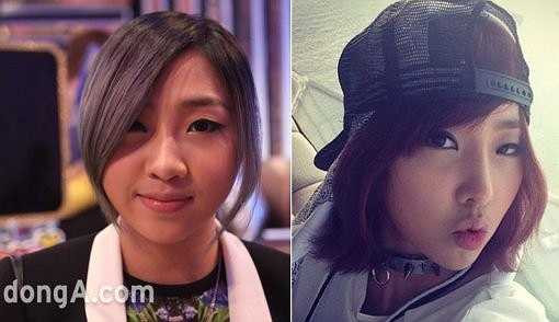 Tương tự như Kim Hyun Joong, 'em út' 2NE1 Minzy đã sửa mũi trong lần phải phẫu thuật vì viêm mũi.