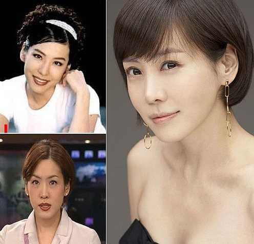 Kim Jung Eun lên tiếng về phẫu thuật thẩm mỹ trong cuộc phỏng vấn gần đây. Tuy nhiên, ngôi sao All about Eve lại khuyên các đồng nghiệp rằng: 'Hãy giấu càng lâu càng tốt'.