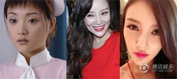 Lý Tiểu Lộ: Từ gương mặt tròn trịa trước kia, Lý Tiểu Lộ mặt ngày dài, cằm nhọn ra trông thấy. Nhiều người cho rằng cô đã sai lầm khi thẩm mỹ. (Nguồn: Zing)