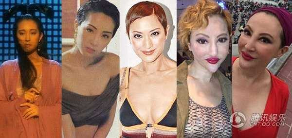 Tiết Chỉ Luân: Người đẹp một thời trở thành 'thảm họa thẩm mỹ' từ gần 10 năm nay. Nhìn hình ảnh ngày ấy và bây giờ, khó tin rằng họ là một người.