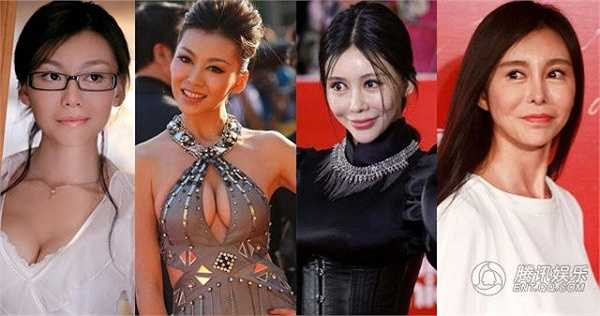 Củng Tân Lượng mất đi bạn trai vì thị phi trùng tu nhan sắc, chịu hậu quả biến dạng vì thẩm mỹ. Cô thừa nhận đánh mất quá nhiều điều chỉ vì dao kéo.