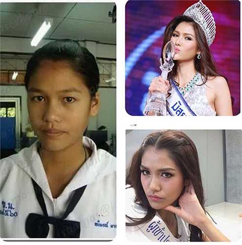 Tuy nhiên, bên cạnh những ý kiến ngợi khen, một số cư dân mạng đã tìm ra bức ảnh cũ kém sắc của tân hoa hậu. Hình ảnh của cô bé Aniporn trong ảnh khiến không ít người tỏ ra hoài nghi về việc liệu nữ hoàng nhan sắc mới của Thái Lan đã trải qua phẫu thuật thẩm mỹ hay chưa.