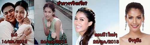 Trong bức ảnh cũ, nữ sinh Aniporn có phần trán dô, mí mắt sụp, đầu mũi to và khuôn miệng cũng không hề đẹp rạng rỡ như ở thời điểm hiện tại. Một số cư dân mạng còn cho rằng để có khuôn cằm Vline hiện tại, tân hoa hậu cũng đã nhờ tới các thủ thuật gọt cằm tại thẩm mỹ viện.