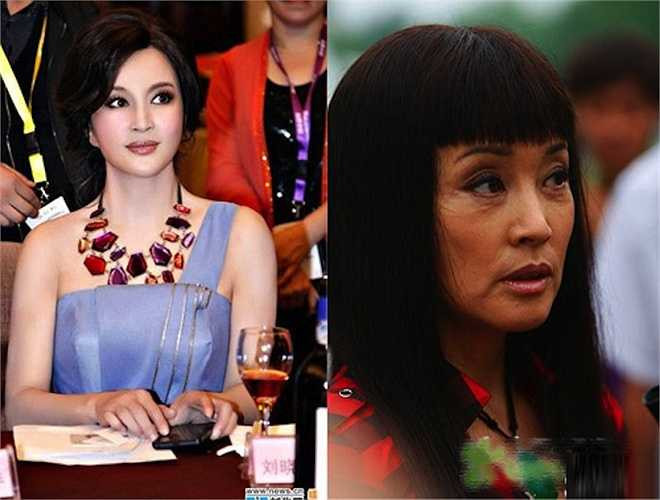 Gương mặt bất thường của Lưu Hiểu Khánh cho thấy dường như cô đã phải trải qua vô số ca phẫu thuật căng da mặt hoặc tiêm botox khiến cử động cơ mặt thiếu tự nhiên