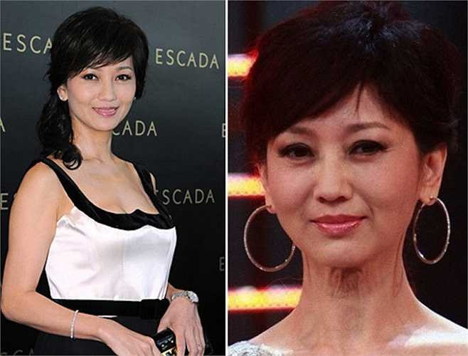 Cùng cổ của Triệu Nhã Chi hằn rõ dấu vết tuổi tác