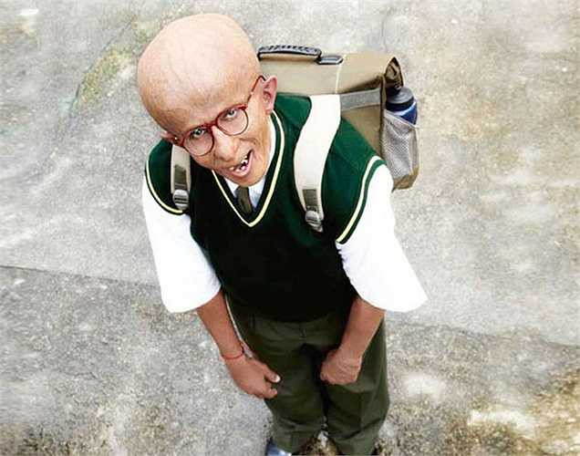 Già sớm: Bạn có thể thấy căng thẳng ảnh hưởng đến cả trẻ, do các nguyên nhân như áp lực của các kỳ thi, bạo lực ở nhà và nhiều lý do khác. Điều này làm cho các tế bào của cơ thể già nhanh gây nên hiện tượng tóc ngả màu, da nhăn, thị lực yếu, 