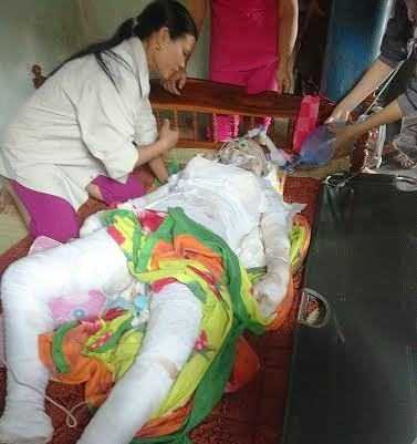 Người vợ trẻ bị chồng tưới xăng thiêu sống đã tử vong