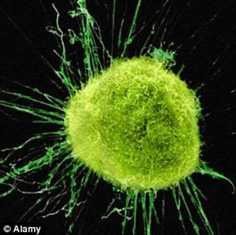 Các nhà khoa học đã chỉ ra rằng ung thư tuyến tiền liệt có thể được phân thành 5 loại, tùy thuộc vào DNA.