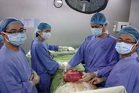 Phẫu thuật, lấy khối u, khổng lồ, ổ bụng, nữ bệnh nhân, Đà Nẵng