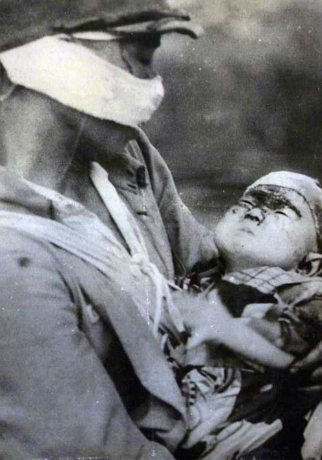 Những em bé bị thương được gói tạm trong những miếng vải rách nát 