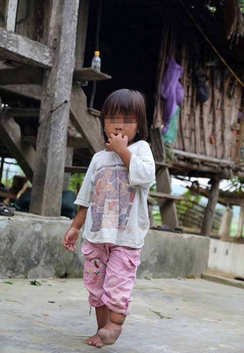 Những đứa trẻ tật nguyền, hệ quả của hôn nhân cận huyết, một vấn đề nan giải mà đến giờ chưa có lối thoát. Những đứa trẻ tật nguyền, hệ quả của hôn nhân cận huyết, một vấn đề nan giải mà đến giờ chưa có lối thoát.