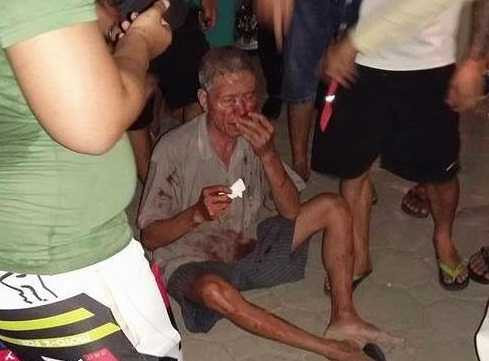 Va chạm giao thông, nam thanh niên đánh cụ ông 70 tuổi chảy máu