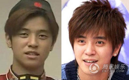 sao nam phẫu thuật thẩm mỹ