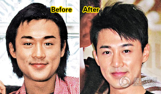 sao nam phẫu thuật thẩm mỹ