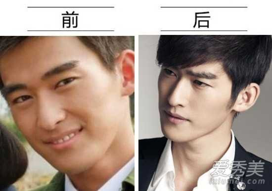 sao nam phẫu thuật thẩm mỹ