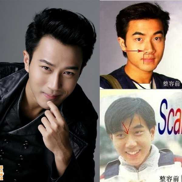 sao nam phẫu thuật thẩm mỹ