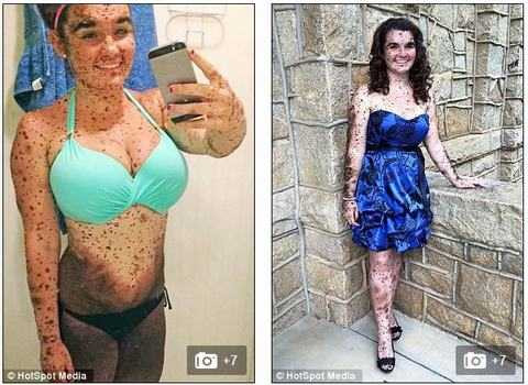 Ciera vẫn luôn tự tin về vẻ ngoài đặc biệt của mình.