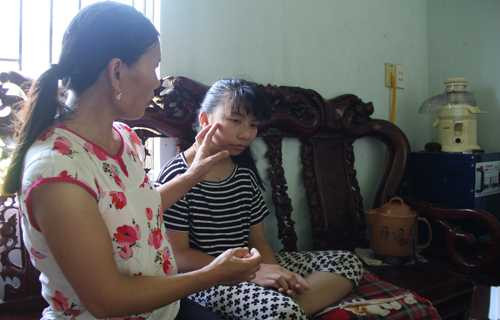 Vụ tai nạn điện khiến chị Thế bị phổng rộp nhiều chỗ trên bàn tay còn con gái phải nhập viện, trên mặt bé Phương Anh còn để lại nhiều vết sẹo. Ảnh: Lê Hoàng.