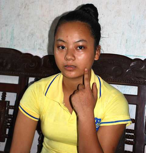 Em Nhung chỉ nửa bên mặt bị liệt ngày nào Em Nhung chỉ nửa bên mặt bị liệt ngày nào