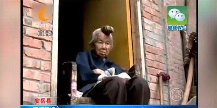 ‘Mẹ tôi già rồi, mà cái sừng trên đầu mẹ lại ở vị trí khá nhạy cảm. Tôi không tin tưởng vào giải pháp phẫu thuật. Nếu có điều gì tồi tệ xảy ra thì sẽ thật tồi tệ', anh Wang chia sẻ.