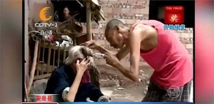 Hàng ngày, anh Wang phải vệ sinh sạch sẽ chỗ rỉ máu, nơi chiếc sừng tiếp xúc với vùng trán của bà Liang.
