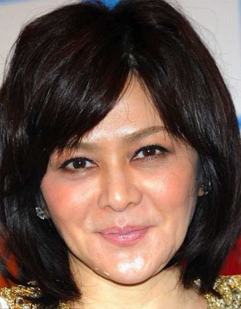 Gương mặt của Quan Chi Lâm trước đó đã có nhiều dấu hiệu của việc tiêm chất làm căng da