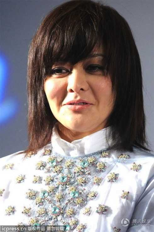 Gương mặt của Quan Chi Lâm trước đó đã có nhiều dấu hiệu của việc tiêm chất làm căng da