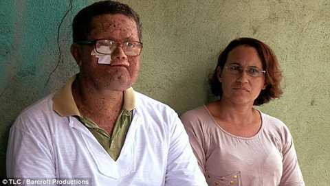 Vì bệnh lạ, cuộc sống của Deide hoàn toàn đảo lộn