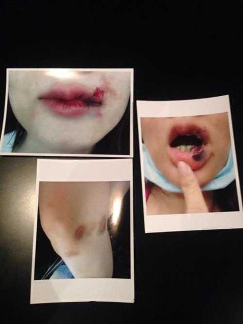 Dương Yến Ngọc tố cáo chồng bạo hành