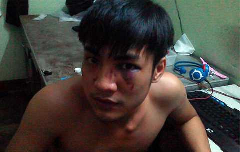 Người dân, tố cáo, công an phường, đánh nhập viện, Đà Nẵng