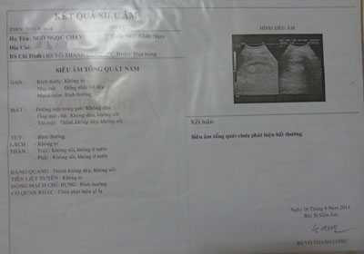 Kết quả siêu âm mới nhất của ông Chín Chạy
