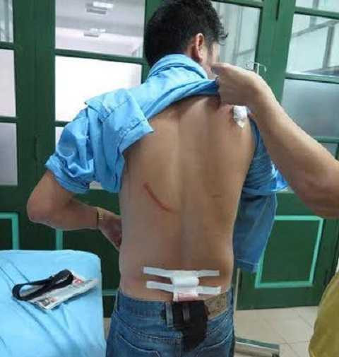 Những vết thương trên người nhà báo Nguyễn Ngọc Quang Những vết thương trên người nhà báo Nguyễn Ngọc Quang