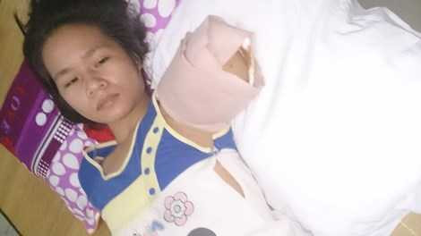 Nạn nhân Trần Thị Yến bị hổ nuôi vồ đứt tay - trên giường cấp cứu tại Bệnh viện chấn thương chỉnh hình Nghệ An Nạn nhân Trần Thị Yến bị hổ nuôi vồ đứt tay - trên giường cấp cứu tại Bệnh viện chấn thương chỉnh hình Nghệ An