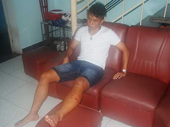 Anh Khoa chấn thương