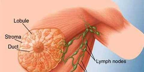 Ung thư vú - nỗi lo kinh hoàng của phụ nữ sẽ được tiêu diệt trong thế kỷ 21. Ung thư vú - nỗi lo kinh hoàng của phụ nữ sẽ được tiêu diệt trong thế kỷ 21.