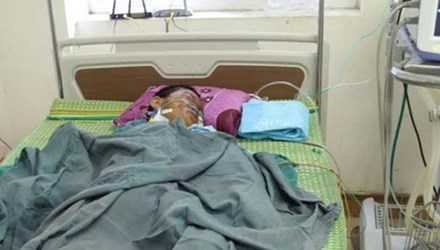 Tụ điện bóng đèn cao áp phát nổ khiến em Long phải vào bệnh viện cấp cứu.