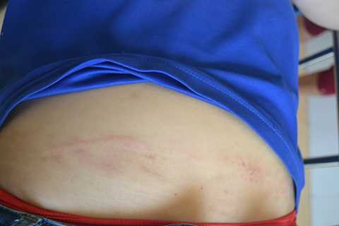 Đà Nẵng, công nhân bị đánh nhập viện, đầy thương tích, bị đánh đập, Công ty TNHH MTV May mặc Tân Phát Lộc, KCN Hòa Khánh Đà Nẵng, người Hàn Quốc làm Giám đốc.