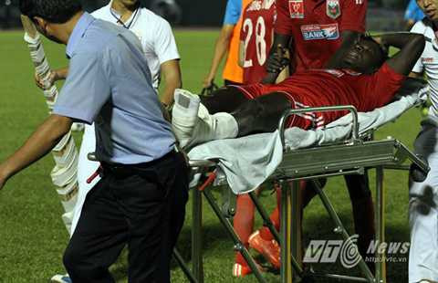 Abass được nẹp chân trước khi lên xe cấp cứu (Ảnh: Hoàng Tùng) Abass được nẹp chân trước khi lên xe cấp cứu (Ảnh: Hoàng Tùng)