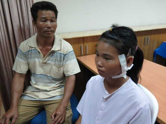 Bệnh nhi bị đạn lạc găm vào cổ đã hồi phục. Ảnh: Khánh Trung.