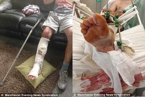 Parsons đã phải mất nhiều tháng liền mới có thể đi lại được Parsons đã phải mất nhiều tháng liền mới có thể đi lại được